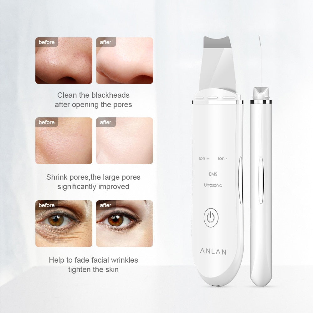 Ultrasonic Skin Scrubber with stainless steel spatula for deep cleansing, pore tightening, and skin smoothing effects.
